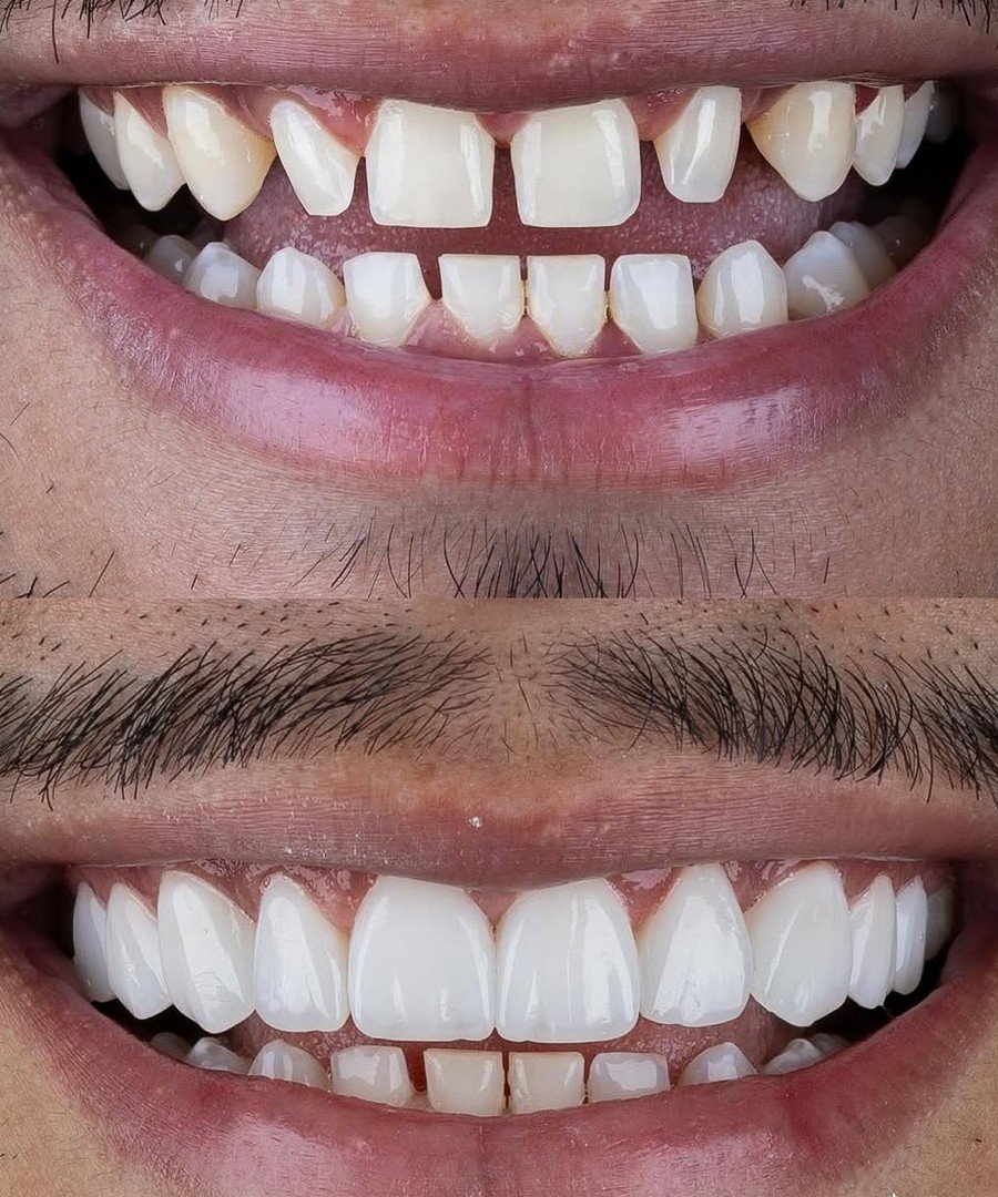 Antes e depois, caso 3